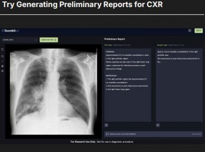 [숨빗AI 자료 캡처]